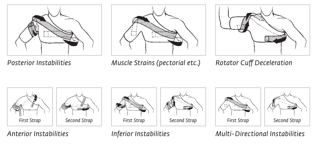 DonJoy® Sully Shoulder Brace - DonJoy, import_2021_01_27_202244, Shoulder, Shoulder Brace by Supply Physical Therapy